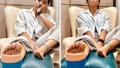 Rashmika Mandanna confirms about sustaining leg injury; pens note apologizing to filmmakers : Bollywood News - Bollywood Hungama