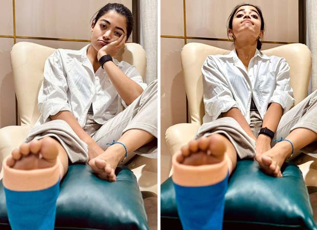 Rashmika Mandanna confirms about sustaining leg injury; pens note apologizing to filmmakers : Bollywood News - Bollywood Hungama