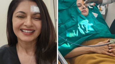 Bhagyashree gets 13 stitches on forehead after getting injured while playing pickleball : Bollywood News - Bollywood Hungama