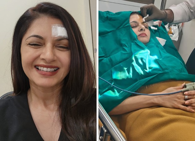 Bhagyashree gets 13 stitches on forehead after getting injured while playing pickleball : Bollywood News - Bollywood Hungama