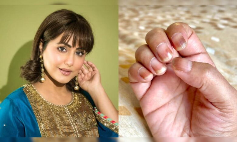 Hina Khan, Battling Cancer, On Side-Effects Of Chemotherapy: "My Nails Have Become Brittle And Dry"